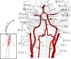 The carotid arteries are major blood vessels in the neck that supply blood to the brain, neck, and face. On The Anatomical Definition Of Arterial Networks In Blood Flow Simulations Comparison Of Detailed And Simplified Models Springerlink