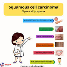 squamous cell carcinoma signs