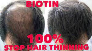 crazy hair growth with biotin shoo
