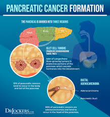 pancreatic cancer symptoms causes and