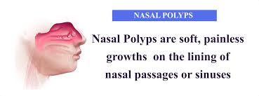 nasal polyp causes homeopathy