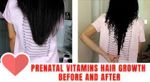 see prenatal vitamins hair growth