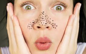 home remes for blackheads to get rid