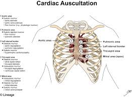 Heart Murmurs Cardiovascular Medbullets Step 1
