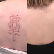 Laser removal is a simple, quick, reliable, and easy solution to a bad tattoo. Tattoo Removed After 3 Sessions Patience And A Great Technician Used Picosure Laser Pic On The Left Is After First Session Right Is 6 Months Post Third Session Tattooremoval