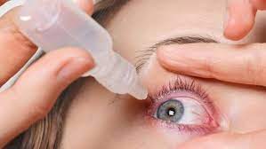 conjunctivitis simple home remes to