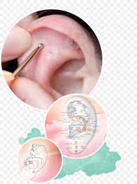 Auriculotherapy Acupuncture Auricle Ear Png 1000x1341px