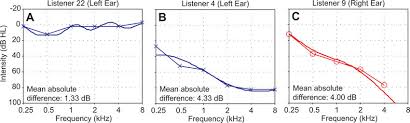 Sample Plots Of Ml Audiogram Results For A An Ear With