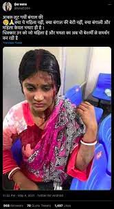 The viral photo claimed as owasi's welcome in uttar pradesh is actualy from a 3 year old eid rally in bangladesh. Old Photo Of Woman Injured In Bangladesh Linked To West Bengal Post Poll Violence Alt News