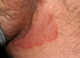 rash causes and how it s treated