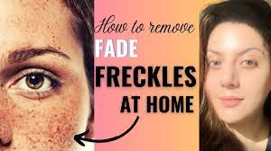 how to fade freckles on face naturally