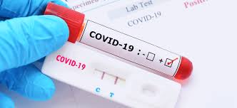 how to avail covid 19 test for free of