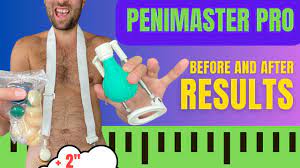 Penimaster PRO User Reviews and Results. Before and After - YouTube