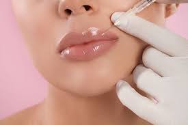 getting lip fillers injections