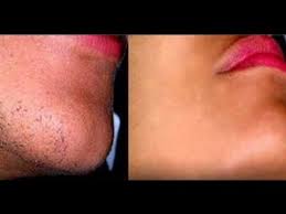 We recommend checking out these hair removal creams. Home Remedies To Remove Facial Hair Permanently Female Facial Hair Chin Hair Unwanted Hair Removal