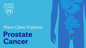 prostate cancer symptoms and causes