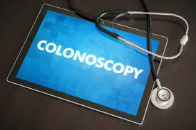 screening colonoscopies