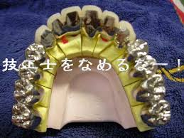 「歯科技工」の画像検索結果