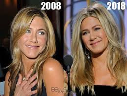 The jennifer aniston effect is an enduring phenomenon uncovered by scientists. Jennifer Aniston Plastic Surgery Before And After Photos