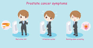 Risk factors include age, family history, ethnicity, and diet. Prostate Cancer Signs Symptoms Risks Prevention
