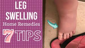 7 tips for leg swelling treatment at