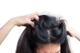scalp yeast infection symptoms causes