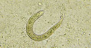 Würmer, die man im menschlichen stuhl sieht, können parasiten verschiedener arten sein identifizierung man kann auch nur ein stückchen des bandwurms oder der taenia im stuhl finden. Fadenwurmer Nematoden Symptome Infektionsgefahr Therapie Netdoktor