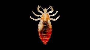 body lice infestation causes symptoms