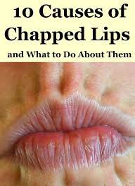 chapped lips blank template flip
