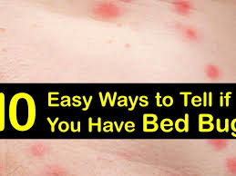 10 easy ways to tell if you have bed bugs