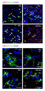 Dexamethasone inhibits the Nox-dependent ROS production via suppression of  MKP-1-dependent MAPK pathways in activated microglia | BMC Neuroscience |  Full Text