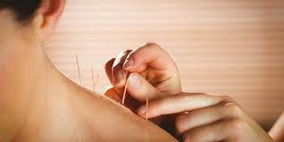 acupuncture helps re balance