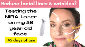 nira skincare laser results at 45 days