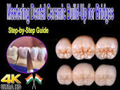 Mastering Dental Ceramic Build-Up for Bridges: Step-by-Step Guide ...