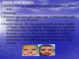 cleft lip and cleft palate pdf د احمد