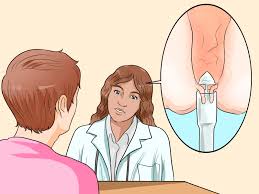 However, the symptoms are still present because of disturbed circulation. 3 Ways To Get Rid Of Hemorrhoids Wikihow