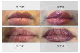 semi permanent lips perfect lips