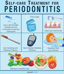 stop periodonis ehealth