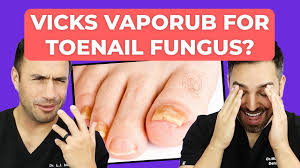 ointment to cure toenail fungus