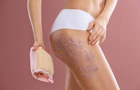how to get rid of scars on the legs