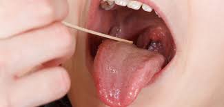 do you know what s in your mouth poz