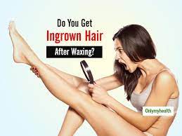 do ingrown hair after waxing annoy you