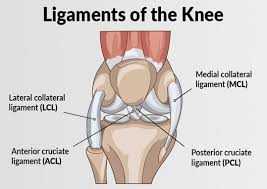 Bruising around the knee, especially around the location of the mcl (inner knee). Acl And Mcl Injuries Xcell Medical Group Elyria Ohio