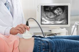 What to Expect at Your First Ultrasound