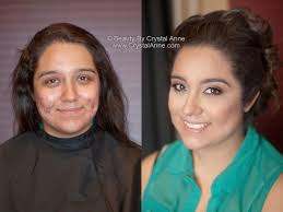 airbrush makeup for acne