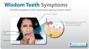 wisdom teeth removal explained by costa