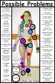 Downloadable Fibromyalgia Tender Points Charts Car Pictures