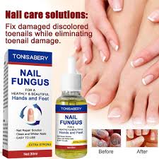 30ml nail repair essence nail toenail