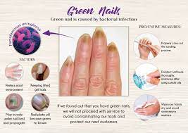 your nails green