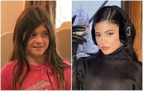 Kylie jenner before and after: Timeline Kylie Jenner S Rise From Gawky Teen On Keeping Up With The Kardashians To Billionaire Kylie Cosmetics Entrepreneur South China Morning Post